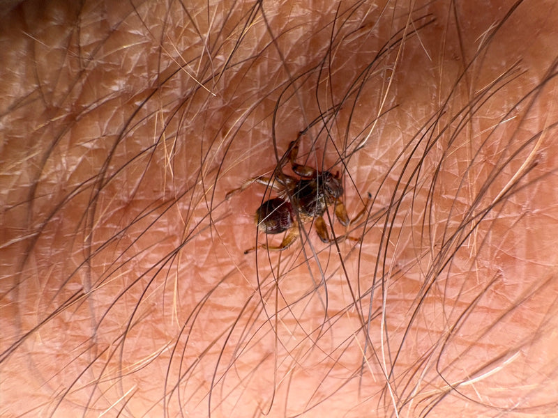 Eine ausgewachsene Hirschlausfliege krabbelt auf menschlicher Haut umgeben von Haaren. Das Insekt ist gut zu erkennen.