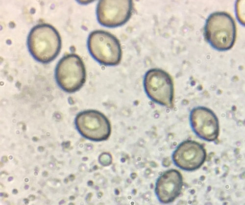 Kugeliger Borstenkugelpilz — Bild 2 von 21